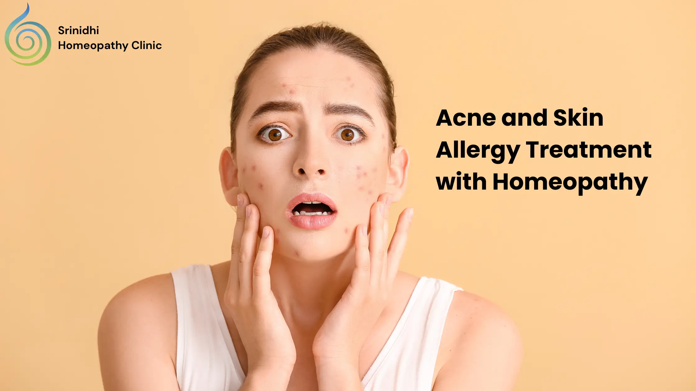 Acne and Skin Allergy Treatment with Homeopathy